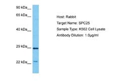 SPC25 Antibody, Novus Biologicals 100 &mu;L; Unconjugated:Antibodies, Polyclonal